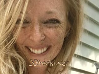 Xfreckledx
